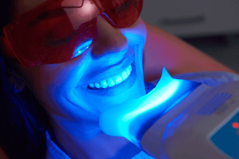 Teeth Whitening