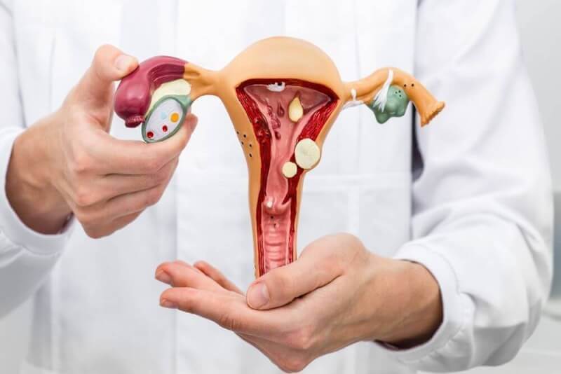 Endometrial Polip