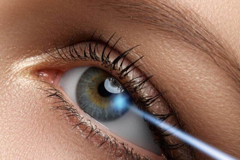 Göz Çizdirme (Lazer Göz) Ameliyatı
