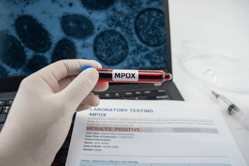 Mpox Virus