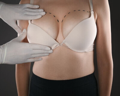 Wear a Bra After Breast Augmentation Surgery 