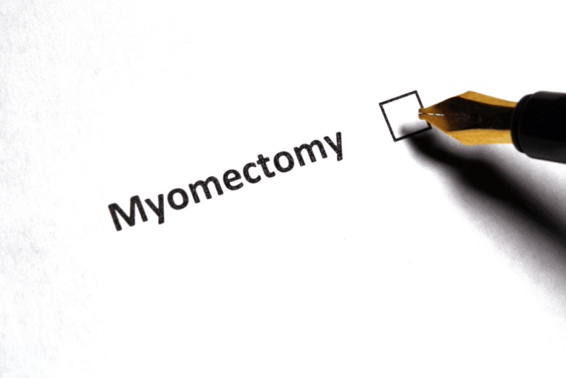 Myomektomi