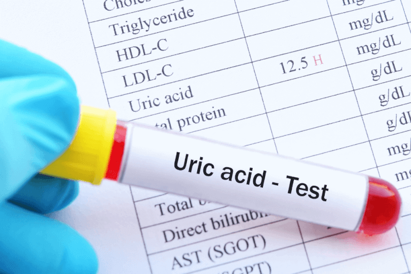 Uric Acid